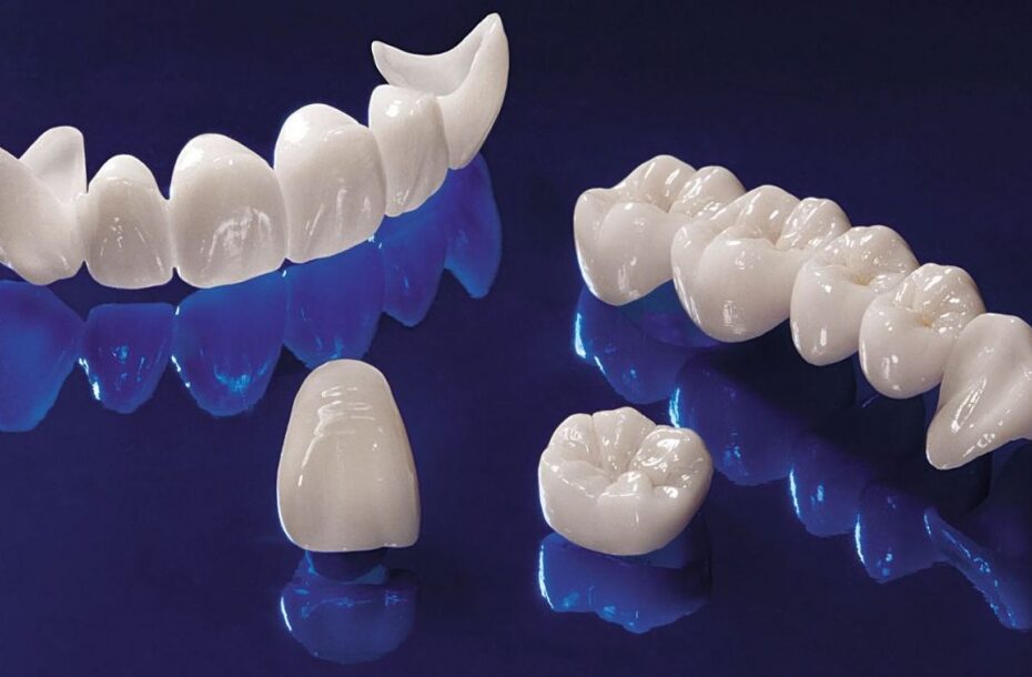 Non-metallic ceramics in dentistry: applications and benefits