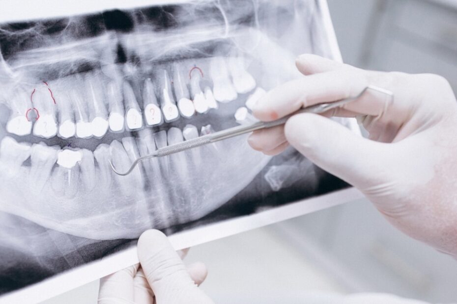 Modern Dental Diagnosis and Computer Technology